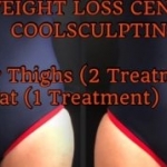 OC Weight Loss Centers &amp; CoolSculpting