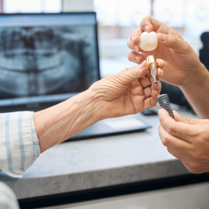 Dental Implants Palm Beach Gardens